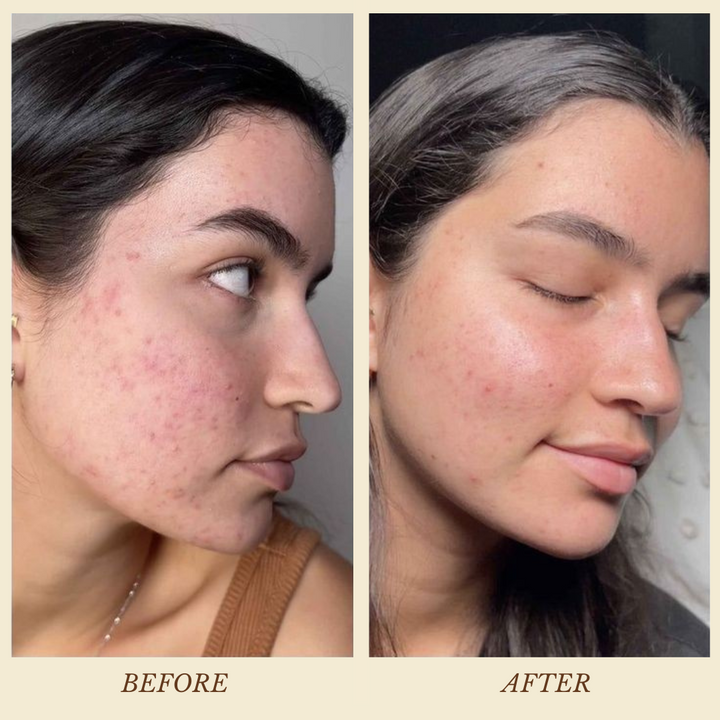 Before and after comparison of a woman&