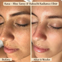 Before and after comparison of a woman's face with Rasa Blue Tansy & Bakuchi Radiance Elixir.