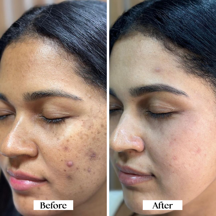 Before and after comparison of a woman&