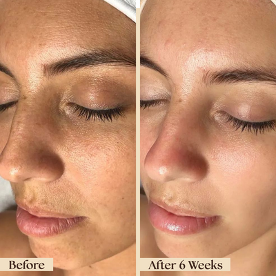 Rasa Before and After Image