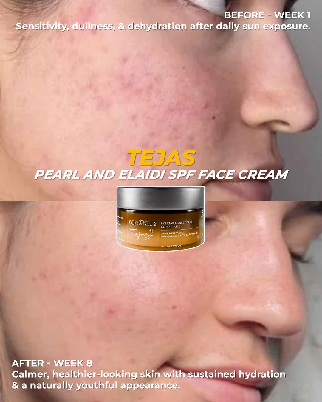 Tejas-Pearl & Elaidi SPF Face Cream| SPF 30 | PA++